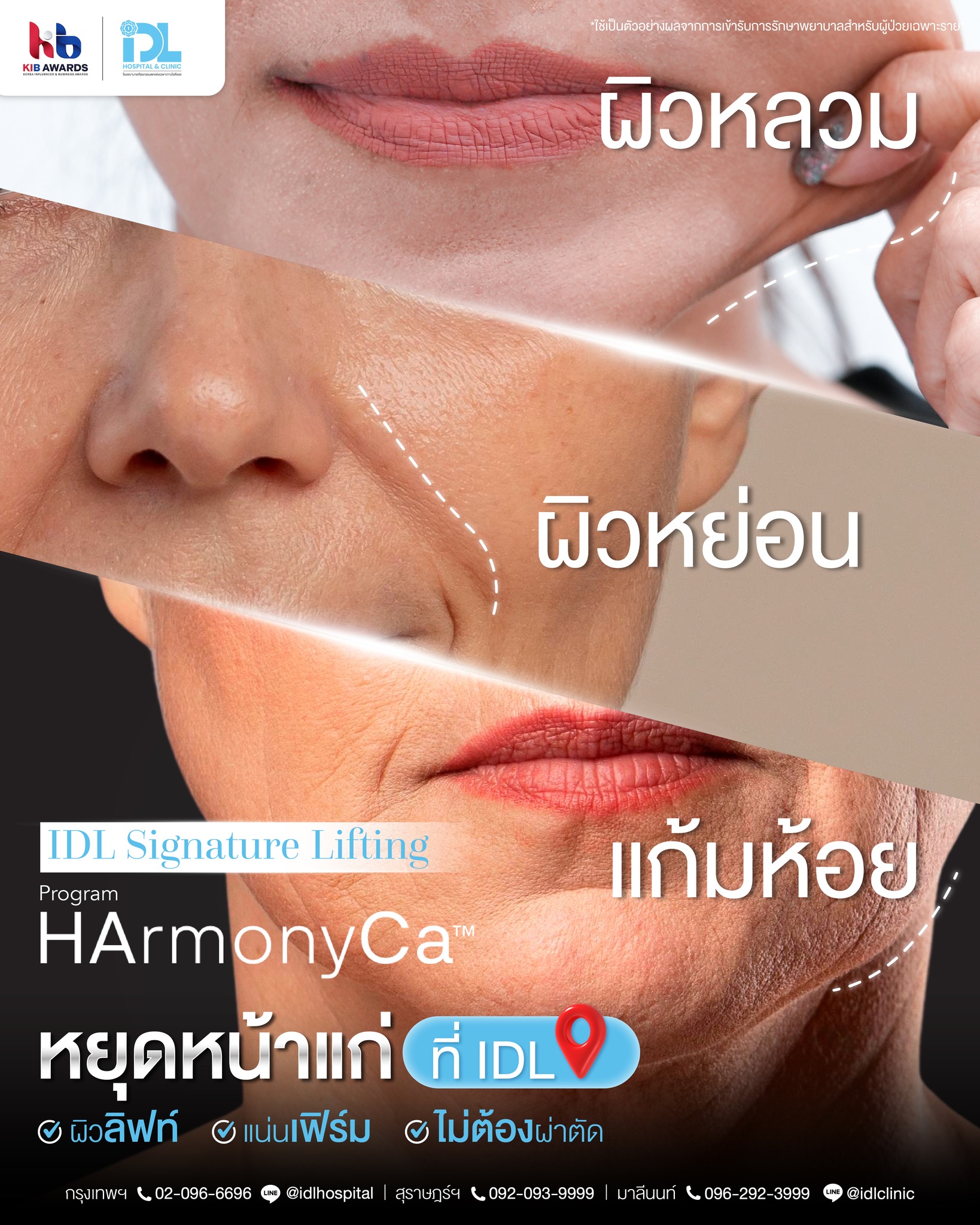 LINE_ALBUM_HARMONYCA_0_0