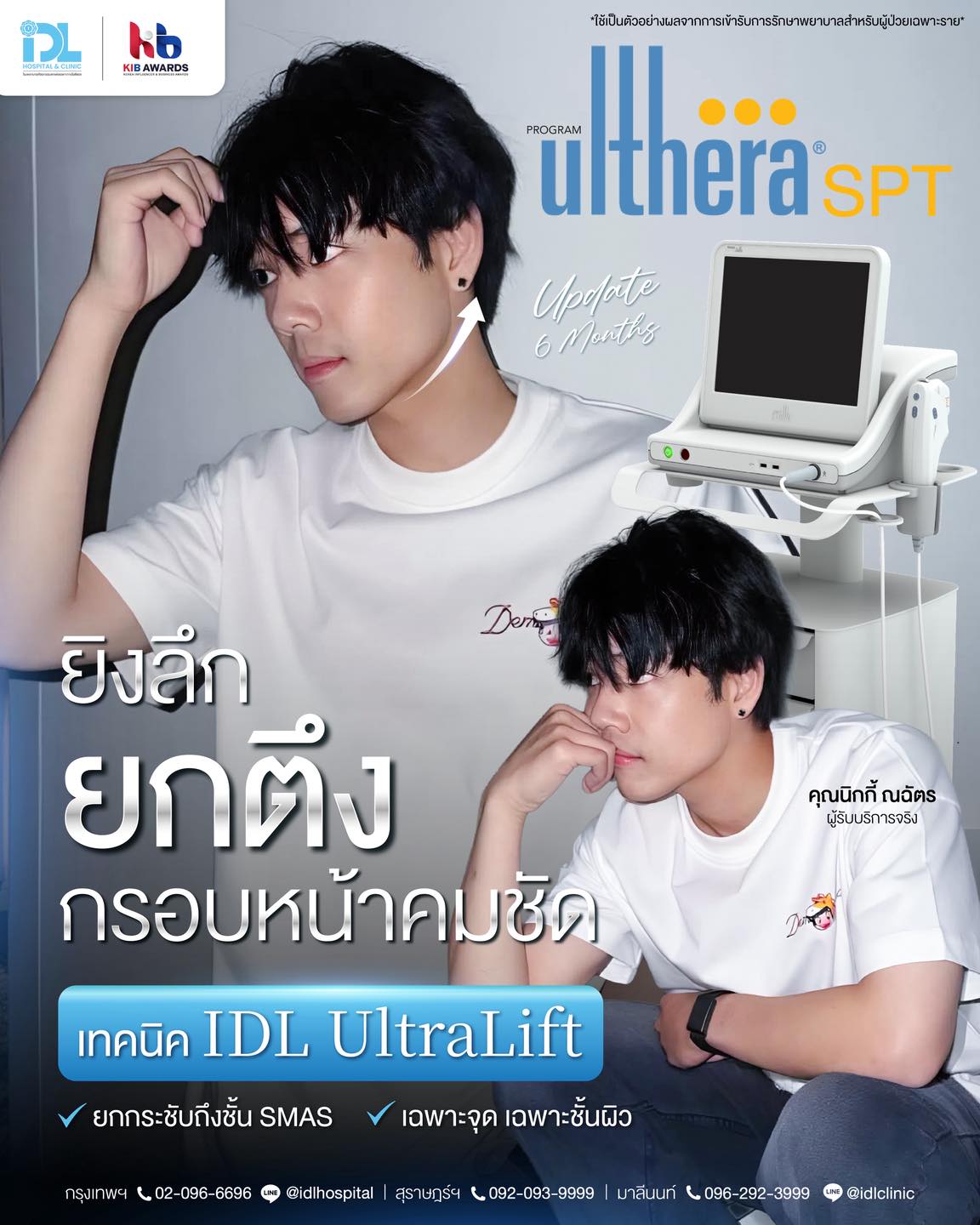 ULTHERAPY SPT_0_0