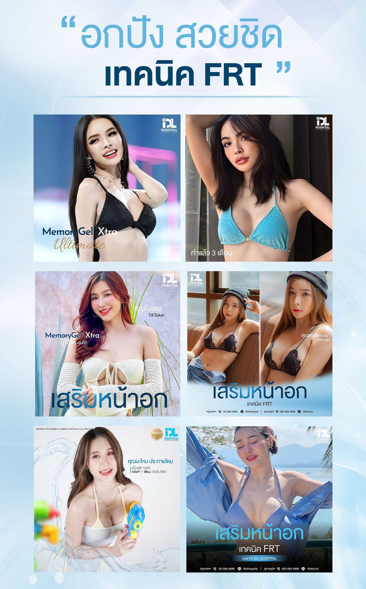 รีวิว เสริมหน้าอก