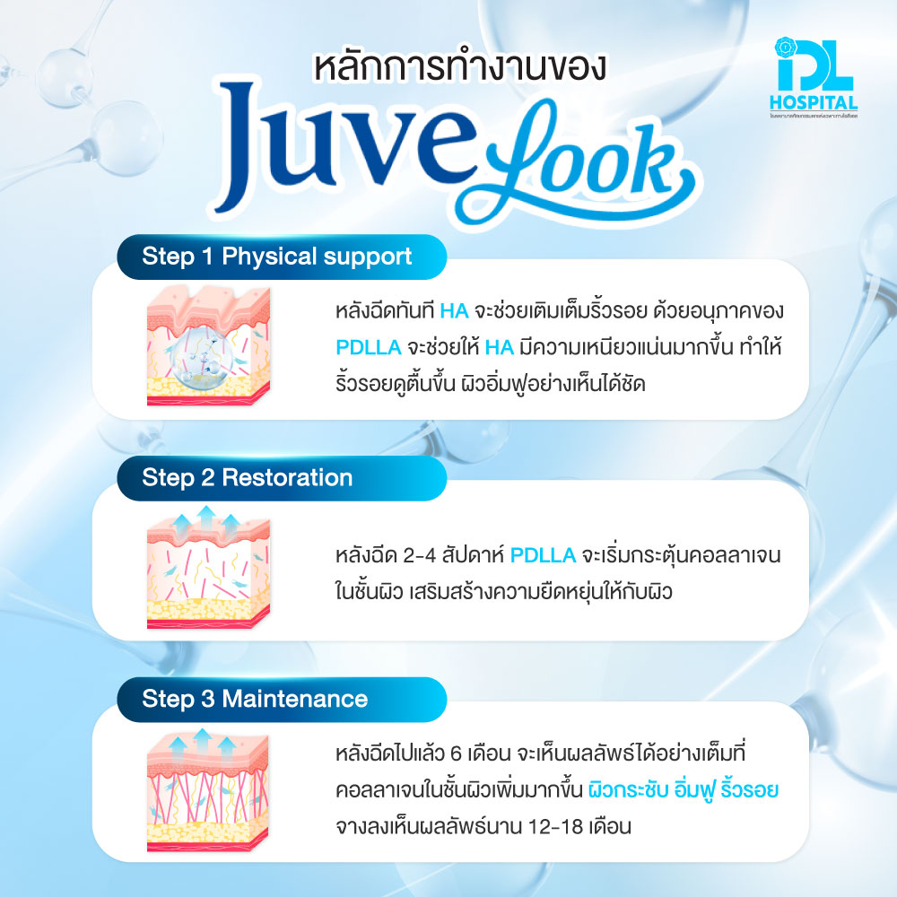 Juvelook