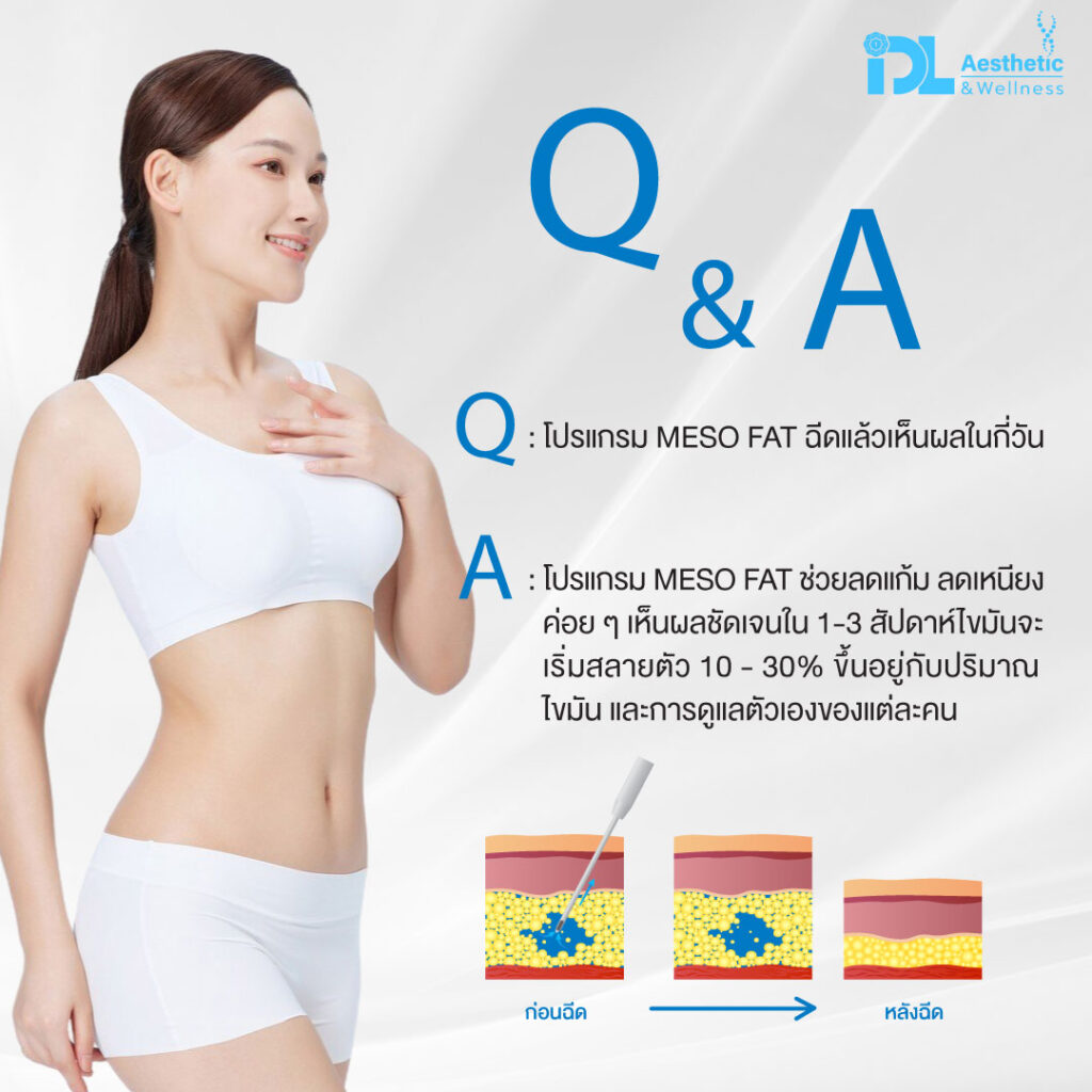 meso fat สลายไขมัน