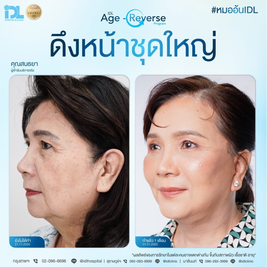รีวิว ดึงหน้าชุดใหญ่