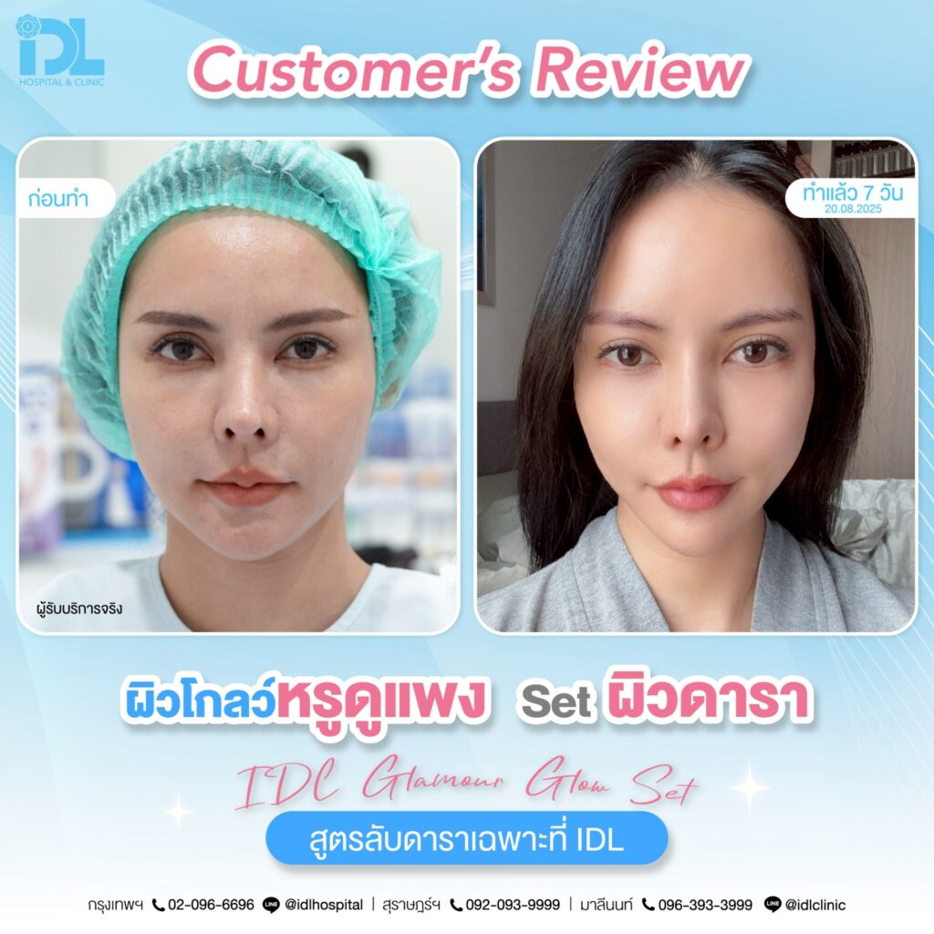 รีวิว เซตผิวดารา