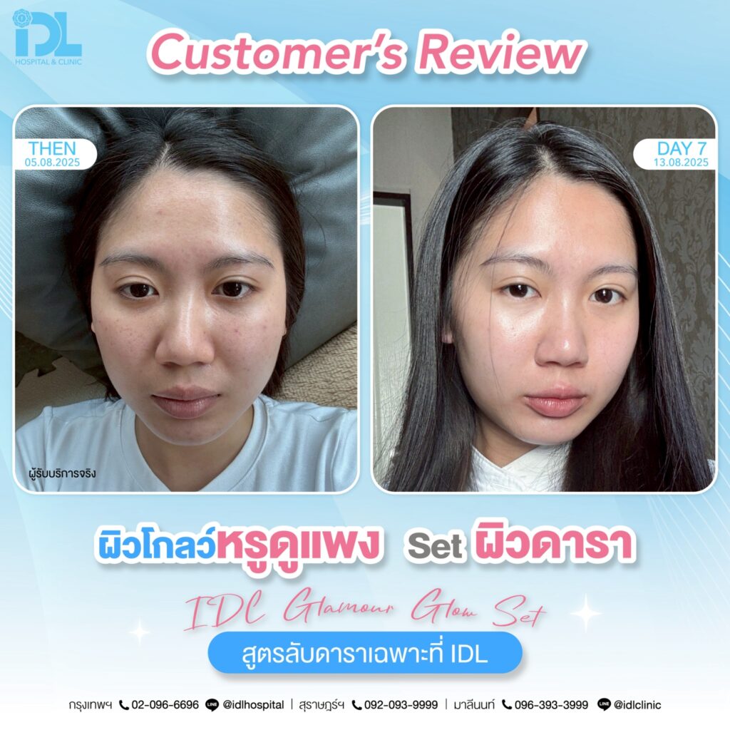 รีวิว เซตผิวดารา