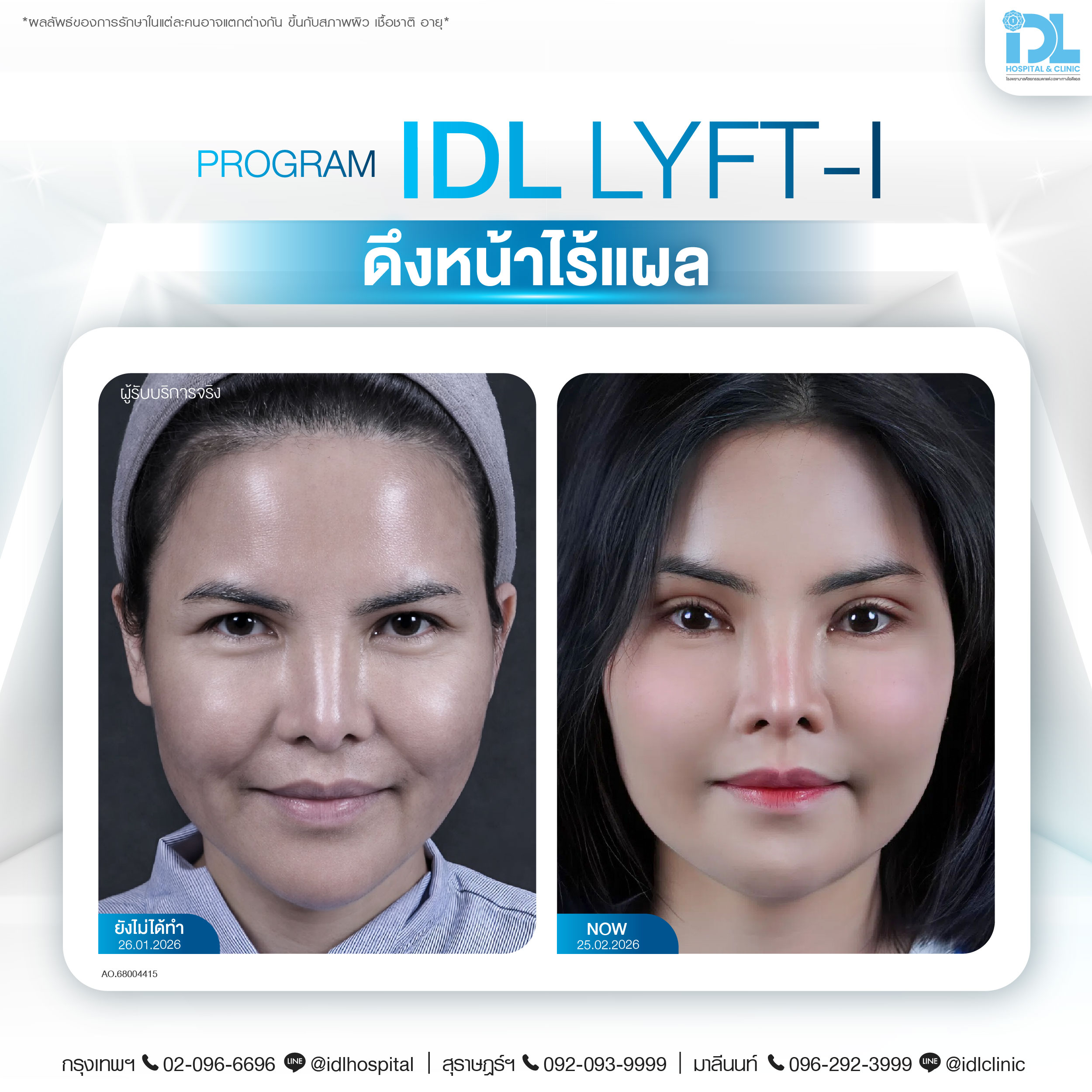 Face Service - IDL HOSPITAL