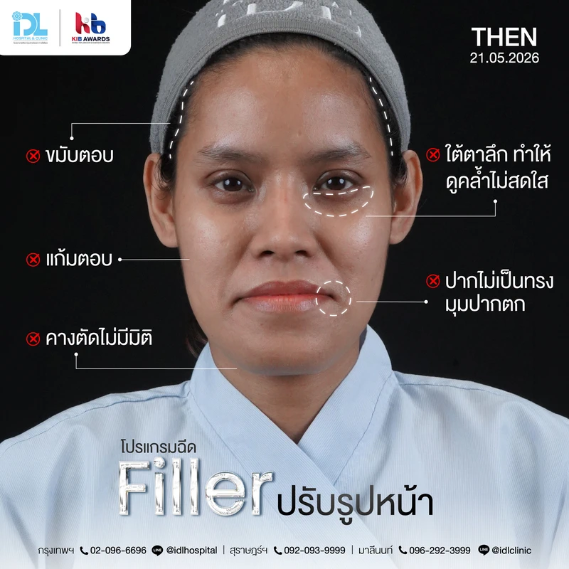 Filler_คุณมด_Surgery Wars-06
