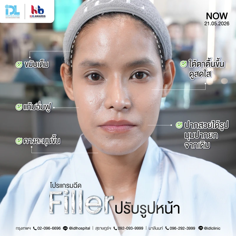 Filler_คุณมด_Surgery Wars-07