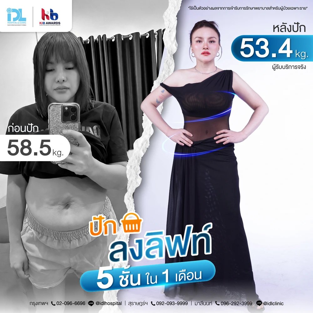 idl-surgery-wars-tummy-idl-body-reset (10)