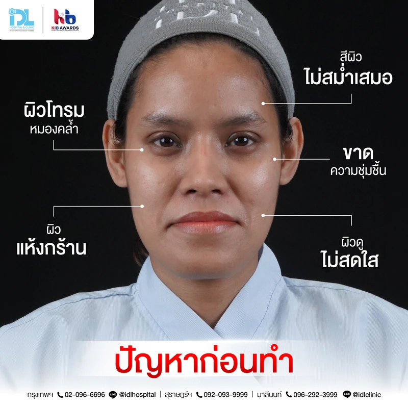 เซตผิวดารา_คุณมด_Surgery-Wars-04